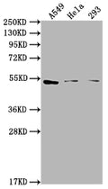 Western Blot
Positive WB detected in: A549 whole cell lysate, Hela whole cell lysate, 293 whole cell lysate
All lanes: CNR1 antibody at 1:2000
Secondary
Goat polyclonal to rabbit IgG at 1/50000 dilution
Predicted band size: 53, 46, 50 kDa
Observed band size: 53 kDa