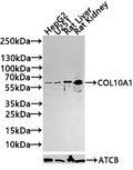 Western blot
All lanes: COL10A1 antibody at 4µg/ml + K562 whole cell lysate
Secondary
Goat polyclonal to rabbit IgG at 1/10000 dilution
Predicted band size: 66 kDa
Observed band size: 66 kDa