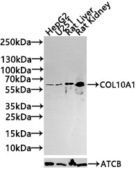 Western blot
All lanes: COL10A1 antibody at 4µg/ml + K562 whole cell lysate
Secondary
Goat polyclonal to rabbit IgG at 1/10000 dilution
Predicted band size: 66 kDa
Observed band size: 66 kDa