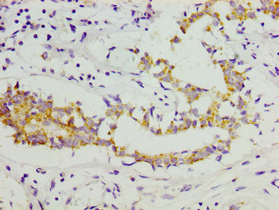 COL11A1 Antibody, Biotin conjugated – Figure 1 of 1