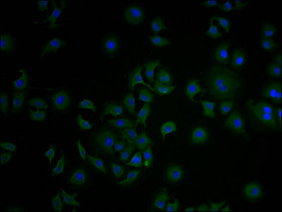 Immunofluorescence staining of A549 cells with CSB-PA005725LA01HU at 1:100, counter-stained with DAPI. The cells were fixed in 4% formaldehyde and blocked in 10% normal Goat Serum. The cells were then incubated with the antibody overnight at 4°C. The secondary antibody was Alexa Fluor 488-congugated AffiniPure Goat Anti-Rabbit IgG(H+L).