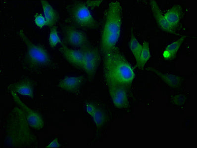 Immunofluorescence staining of U251 cells with CSB-PA005727OA01HU at 1:100, counter-stained with DAPI. The cells were fixed in 4% formaldehyde, permeabilized using 0.2% Triton X-100 and blocked in 10% normal Goat Serum. The cells were then incubated with the antibody overnight at 4°C. The secondary antibody was Alexa Fluor 488-congugated AffiniPure Goat Anti-Rabbit IgG(H+L).