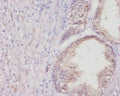 Col1a1 Antibody – Figure 1 of 1