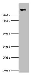 Western blot
All lanes: Collagen alpha-1 (II) chain antibody at 10ug/ml + 293T whole cell lysate
Secondary
Goat polyclonal to rabbit IgG at 1/10000 dilution
Predicted band size: 142, 135, 30 kDa
Observed band size: 142 kDa
