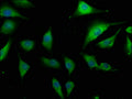 Immunofluorescence staining of U251 cells with CSB-PA005751OA01HU at 1:133, counter-stained with DAPI. The cells were fixed in 4% formaldehyde, permeabilized using 0.2% Triton X-100 and blocked in 10% normal Goat Serum. The cells were then incubated with the antibody overnight at 4°C. The secondary antibody was Alexa Fluor 488-congugated AffiniPure Goat Anti-Rabbit IgG(H+L).