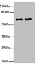 Western blot All lanes: COL9A3antibody at 1.36ug/ml Lane 1: MCF-7 whole cell lysate Lane 2: A549 whole cell lysate Secondary Goat polyclonal to rabbit IgG at 1/10000 dilution Predicted band size: 64 kDa Observed band size: 64 kDa