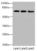 Western blot All lanes: COL9A3antibody at 3.66ug/ml Lane 1: K562 whole cell lysate Lane 2: MCF-7 whole cell lysate Lane 3: A549 whole cell lysate Secondary Goat polyclonal to rabbit IgG at 1/10000 dilution Predicted band size: 64 kDa Observed band size: 64 kDa