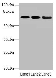 Western blot All lanes: COL9A3antibody at 3.66ug/ml Lane 1: K562 whole cell lysate Lane 2: MCF-7 whole cell lysate Lane 3: A549 whole cell lysate Secondary Goat polyclonal to rabbit IgG at 1/10000 dilution Predicted band size: 64 kDa Observed band size: 64 kDa