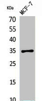 Western Blot analysis of MCF7 cells using IL-12A p35 Polyclonal Antibody.