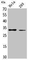 Western Blot analysis of HeLa, 293 cells using SDHB Polyclonal Antibody.