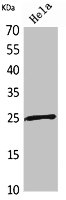 Western Blot analysis of HeLa cells using PRX I Polyclonal Antibody.