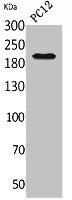Western Blot analysis of PC12 cells using Integrin β4 Polyclonal Antibody.