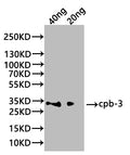 Western Blot
Positive WB detected in: recombinant protein
All lanes:cpb-3 Antibody at 1:1000
Secondary
Goat polyclonal to rabbit IgG at 1/20000 dilution
Predicted band size: 28.5 kDa
Observed band size: 30 kDa