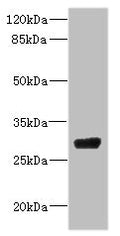 Western blot All lanes: CPSF4 antibody IgG at 4.37ug/ml + 293T whole cell lysate Secondary Goat polyclonal to rabbit IgG at 1/10000 dilution Predicted band size: 31, 28 kDa Observed band size: 31 kDa