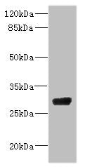 Western blot All lanes: CPSF4 antibody IgG at 4.37ug/ml + 293T whole cell lysate Secondary Goat polyclonal to rabbit IgG at 1/10000 dilution Predicted band size: 31, 28 kDa Observed band size: 31 kDa