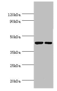 Western blot
All lanes: Cyclic AMP-responsive element-binding protein 3 antibody at 6ug/ml
Lane 1: Jurkat whole cell lysate
Lane 2: HepG2 whole cell lysate
Secondary
Goat polyclonal to rabbit IgG at 1/10000 dilution
Predicted band size: 44, 42, 40 kDa
Observed band size: 44 kDa