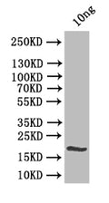 Western Blot
Positive WB detected in: recombinant protein
All lanes:clsA Antibody at 1:1000
Secondary
Goat polyclonal to rabbit IgG at 1/50000 dilution
Predicted band size: 21.8 kDa
Observed band size: 22 kDa