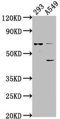 Western Blot
Positive WB detected in: 293 whole cell lysate, A549 whole cell lysate
All lanes: CRTAC1 antibody at 1:1000
Secondary
Goat polyclonal to rabbit IgG at 1/50000 dilution
Predicted band size: 72, 71, 69 kDa
Observed band size: 72 kDa