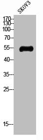 Western Blot analysis of SKOV3 cells using Glut4 Polyclonal Antibody