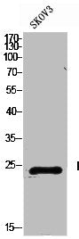 Western Blot analysis of SKOV3 cells using Prolactin Polyclonal Antibody