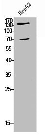 Western Blot analysis of HepG2 cells using COL5A2 Polyclonal Antibody