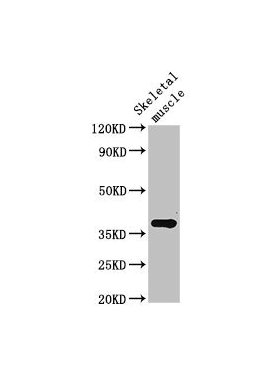 Western Blot
Positive WB detected in: Rat skeletal muscle tissue
All lanes: Ctgf antibody at 3ug/ml
Secondary
Goat polyclonal to rabbit IgG at 1/50000 dilution
Predicted band size: 38 kDa
Observed band size: 38 kDa