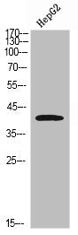 Western Blot analysis of HepG2 cells using IL-3Rα Polyclonal Antibody