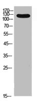 Western Blot analysis of 293 cells using Integrin αL Polyclonal Antibody.