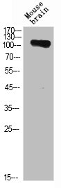 ANPEP Antibody – Figure 1 of 1