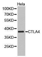 Western blot analysis of extracts of HeLa cell lines, using CTLA4 antibody.