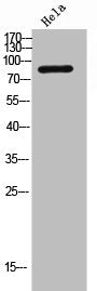 Western Blot analysis of Hela cells using Integrin β1 Polyclonal Antibody