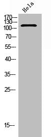 Western Blot analysis of Hela cells using Integrin α5 Polyclonal Antibody