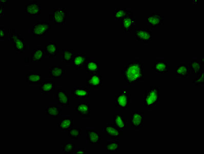 Immunofluorescence staining of Hela cells with CSB-PA006228LA01HU at 1:100, counter-stained with DAPI. The cells were fixed in 4% formaldehyde, permeabilized using 0.2% Triton X-100 and blocked in 10% normal Goat Serum. The cells were then incubated with the antibody overnight at 4°C. The secondary antibody was Alexa Fluor 488-congugated AffiniPure Goat Anti-Rabbit IgG(H+L).