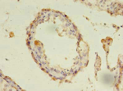 CXADR Antibody, HRP conjugated – Figure 1 of 1