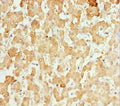 Immunohistochemistry of paraffin-embedded human liver tissue using CSB-PA006244ESR1HU at dilution of 1:100