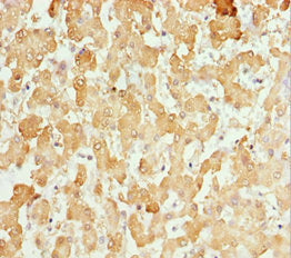 Immunohistochemistry of paraffin-embedded human liver tissue using CSB-PA006244ESR1HU at dilution of 1:100