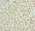 Immunohistochemistry of paraffin-embedded human liver tissue using CSB-PA006244ESR2HU at dilution of 1:100