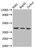 Western Blot Positive WB detected in: K562 whole cell lysate, HepG2 whole cell lysate, Jurkat whole cell lysate All lanes: CXCR3 antibody at 3ug/ml Secondary Goat polyclonal to rabbit IgG at 1/50000 dilution Predicted band size: 41, 46, 29 kDa Observed band size: 41 kDa