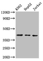 Western Blot Positive WB detected in: K562 whole cell lysate, HepG2 whole cell lysate, Jurkat whole cell lysate All lanes: CXCR3 antibody at 3ug/ml Secondary Goat polyclonal to rabbit IgG at 1/50000 dilution Predicted band size: 41, 46, 29 kDa Observed band size: 41 kDa