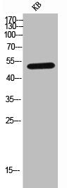 Western Blot analysis of KB cells using IL-7R Polyclonal Antibody