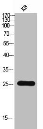 Western Blot analysis of KB cells using CD30-L Polyclonal Antibody