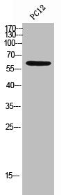 Western Blot analysis of PC12 cells using IL-10Rα Polyclonal Antibody
