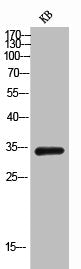 Western Blot analysis of KB cells using EMAP II Polyclonal Antibody