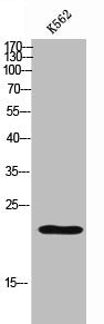 Western Blot analysis of K562 cells using NTN Polyclonal Antibody