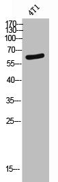 Western Blot analysis of 4T1 cells using BMP-6 Polyclonal Antibody