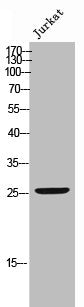 Western Blot analysis of JK cells using Phospho-Bcl-2 (S70) Polyclonal Antibody