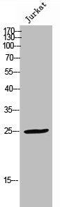 Western Blot analysis of JK cells using Phospho-FADD (S191) Polyclonal Antibody
