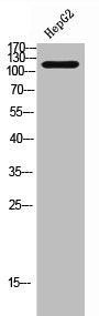 Western Blot analysis of HepG2 cells using Phospho-HDAC5/9 (S259/220) Polyclonal Antibody