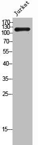 Western Blot analysis of Jurkat cells using VE-Cadherin Polyclonal Antibody
