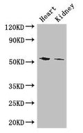 Western Blot
Positive WB detected in: Mouse heart tissue, Mouse kidney tissue
All lanes: CYP11B1 antibody at 3ug/ml
Secondary
Goat polyclonal to rabbit IgG at 1/50000 dilution
Predicted band size: 58, 50 kDa
Observed band size: 58 kDa